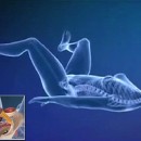 Animation από την Ευρωπαϊκή Εταιρεία Ουρολογίας δείχνει την διαδικασία διόρθωσης φύλου