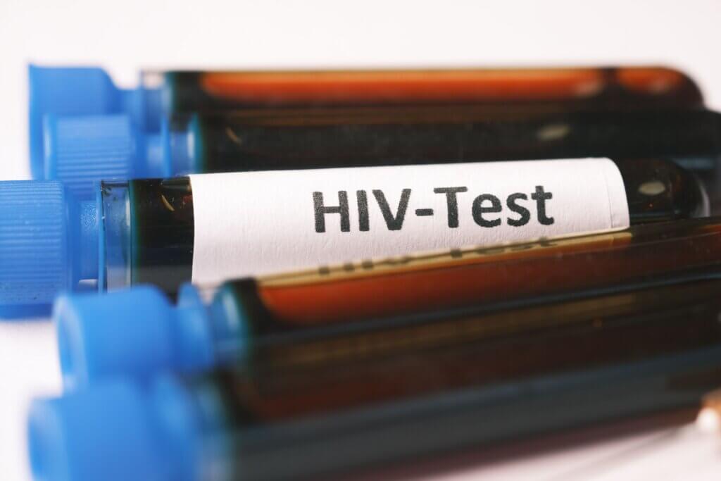 pexels-towfiqu-barbhuiya-3440682-10963257 μπουκαλάκια HIV Test